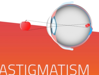 Astigmatism